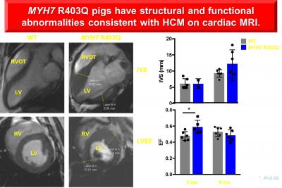 MYH7 R403Q pigs have structural and functional abnomalities consistent with HCM on cardiac MRI